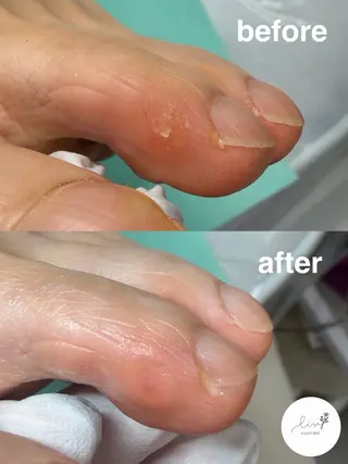 Lise footcareのネイルデザイン