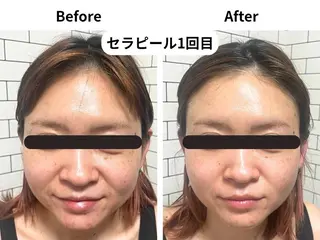 Ageing salon Be.所属・エイジングサロンビー EMIのエステ・リラクイメージ