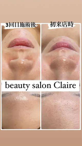ビューティーサロン Claireのエステ・リラクイメージ