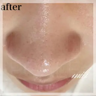 【毛穴ケア専門店✨】 mili 須藤歩華のエステ・リラクイメージ