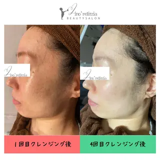 リノレリチア 新町店のエステ・リラクイメージ