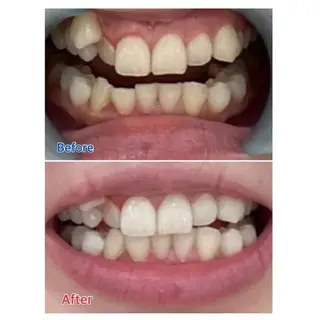 M渋谷店所属・M渋谷 ホワイトニングのエステ・リラクイメージ