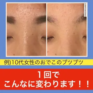 ミディアム カラー パーマ ヘアアレンジ メンズ キッズ ネイル マツエク・マツパ ニキビ・肌質改善専門 ♡人生が変わるサロンのエステ・リラクイメージ