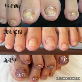 ネイル Welina nailのネイルデザイン