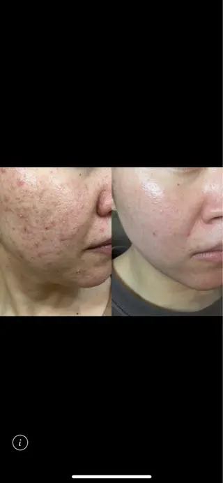 nature  s oin ICHIKAのエステ・リラクイメージ