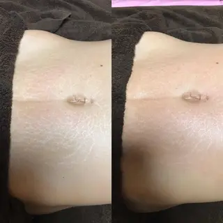 首・肩こり専門リンパ ケアサロンSENKAのエステ・リラクイメージ