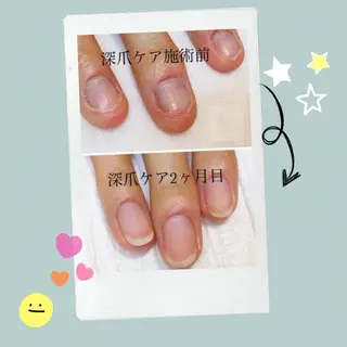 ネイル atelier AURA ｱﾄﾘｴ ｱｳﾗ所属・atelier AURAのネイルデザイン