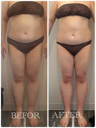 美one所属・宮城 結理亜のエステ・リラクイメージ