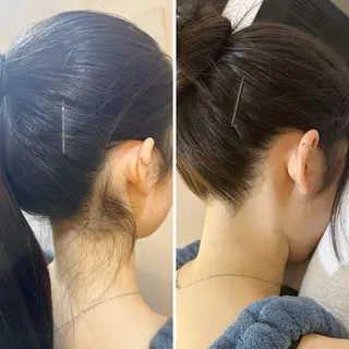 うなじ脱毛/美肌脱毛 LABELのエステ・リラクイメージ