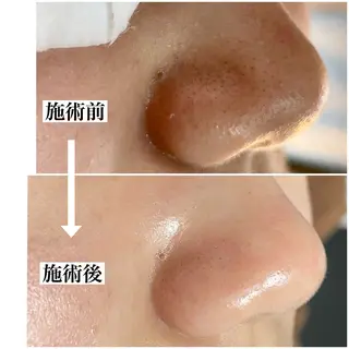 MUKU所属・毛穴専門サロン MUKUムクのエステ・リラクイメージ