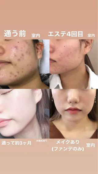 🏳️‍🌈 CHIYAKAのエステ・リラクイメージ