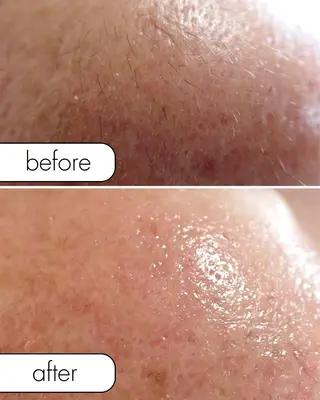 蝶式糸除毛専門salon aco所属・糸除毛専門salon acoのエステ・リラクイメージ