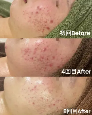 Beauty salon Lei所属・Salon Leiのエステ・リラクイメージ