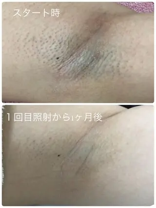 小顔と腸の専門店 ラクーラビューティのエステ・リラクイメージ