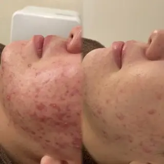 salon MUSUBUのエステ・リラクイメージ