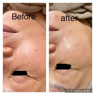 ECXIA ｴｸｼｱのエステ・リラクイメージ