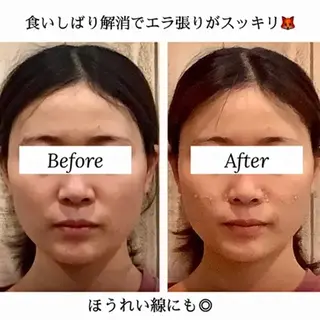 小顔矯正 natsuのエステ・リラクイメージ