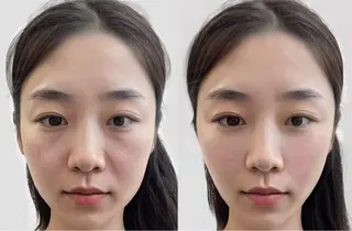 マツエク・マツパ aliaハイフ&水光ジェットサロン所属・aliaハーブ水光店 エステティシャン募集のエステ・リラクイメージ