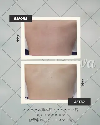 エステWAM所属・エステWAM 髙木のエステ・リラクイメージ