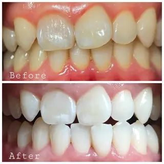 ほわいと あざぶのマツエク・マツパデザイン