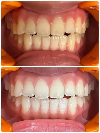 べルーテエッセンス 毛穴洗浄のエステ・リラクイメージ