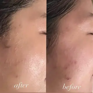 MeguruSalon所属・山口 颯希のエステ・リラクイメージ