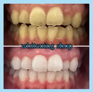 ホワイトニング ショップ千葉店のその他イメージ