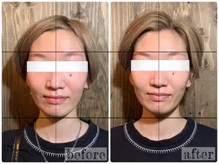 💎後悔させない小顔 矯正💎イトヤマ🌱のエステ・リラクイメージ