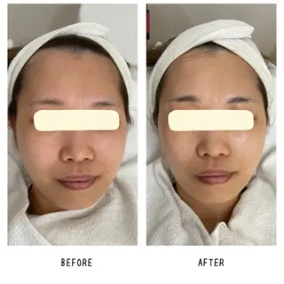 grow所属・Yoshino Erinaのエステ・リラクイメージ