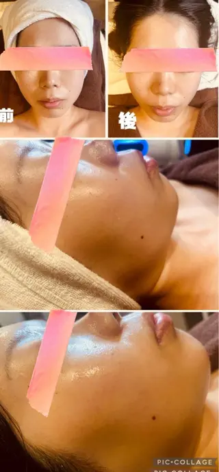 【痩身ダイエット・リンパオイルマッサージ・脱毛】- iromie. 四日市店 - 医療提携所属・佐々木 千愛来のその他イメージ