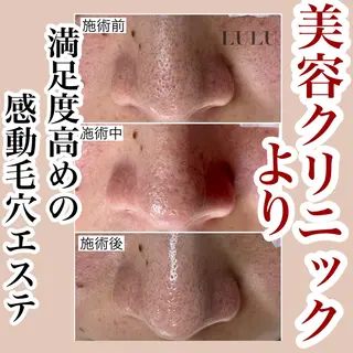 LULU所属・LULU ルルのエステ・リラクイメージ