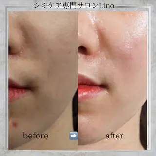 シミケア専門サロンL ino所属・シミケア専門サロン Linoのエステ・リラクイメージ