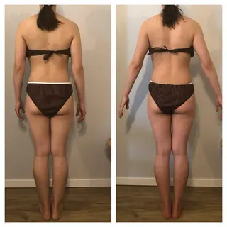 小顔・痩身専門店 Sunao所属・小顔.足痩せ整体 痩身天六Sunaoのその他イメージ