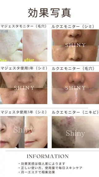 Shiny所属・✨ナリス化粧品✨ Shinyのエステ・リラクイメージ