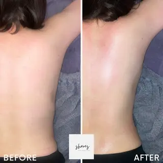 SHARES MADOKAのエステ・リラクイメージ