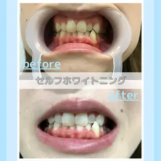 メンズ お手軽ホワイトニングsalon mina所属・武元 奈津美のその他イメージ