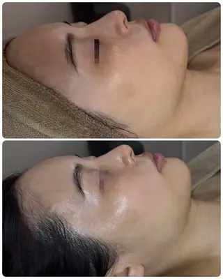 【ハーブピーリング/韓国ツヤ肌ピーリング】RelierBelle-ルリエベル-所属・肌質改善/肌育特化 プライベートサロンのエステ・リラクイメージ