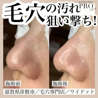 Ydot. 池内 友架のエステ・リラクイメージ