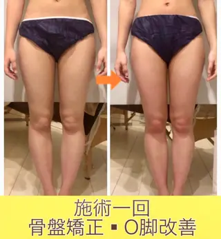 ロング カラー パーマ ヘアアレンジ メンズ キッズ ネイル マツエク・マツパ ‍痩身＆ボディ 結果出し🌟丹野のエステ・リラクイメージ