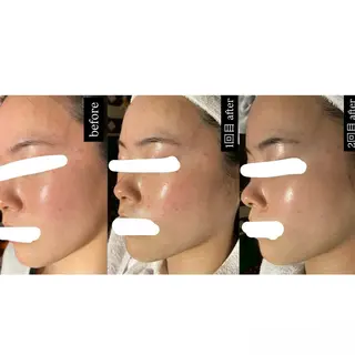 エステサロンPONO所属・PONO 天王寺／エステのエステ・リラクイメージ