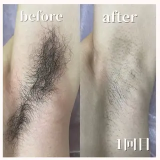 メンズ メンズ脱毛サロン kurozukinのエステ・リラクイメージ