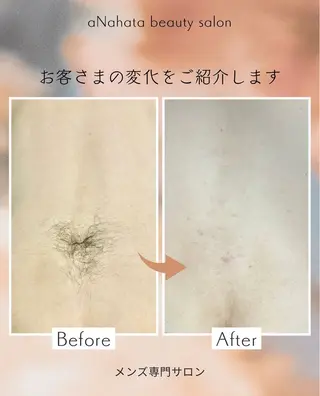 メンズ aNahata beauty salon所属・田中 菜月のエステ・リラクイメージ