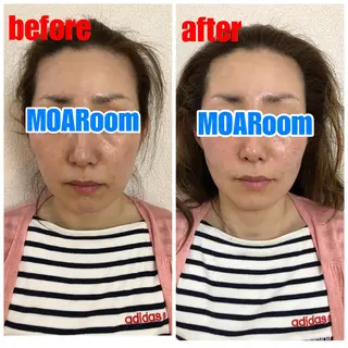 MOARoom所属・毛利 明代のエステ・リラクイメージ