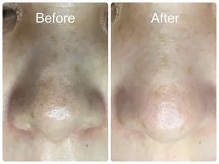 salon HATOのエステ・リラクイメージ