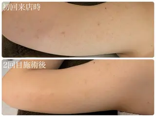 肌管理サロン Briller所属・肌管理サロン Briller 押上のエステ・リラクイメージ