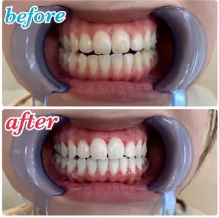 ecxia  white 　広島袋町店所属・セルフホワイトニング エクシア広島袋町店のその他イメージ