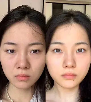 aliaハイフ&水光ジェットサロン所属・aliaハーブ水光店 エステティシャン募集のエステ・リラクイメージ