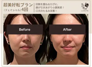 総合美容サロン LOVEME渋谷本店のエステ・リラクイメージ