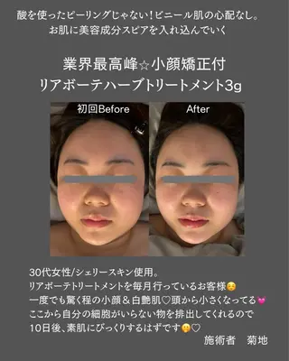 salon BLOSSOMのエステ・リラクイメージ