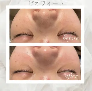 🦋美肌サロン. maho🦋のエステ・リラクイメージ